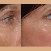 Arkansas Laser & Skin Care